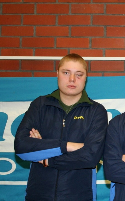 Sami Hyrynsalmi nuorena miehenä nyrkkeilyn jäljiltä.